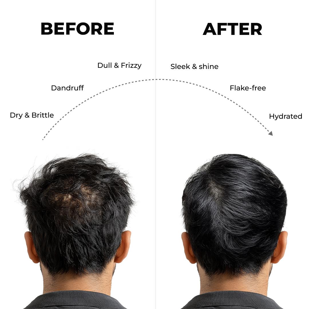 IM shampoo After -Before