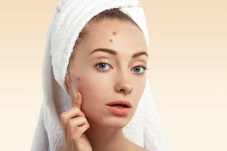 Coffee Scrub for Acne