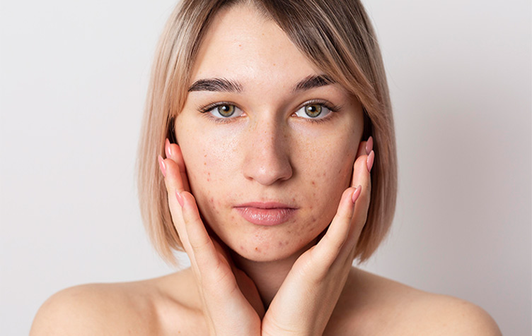 Dark Spots Removal