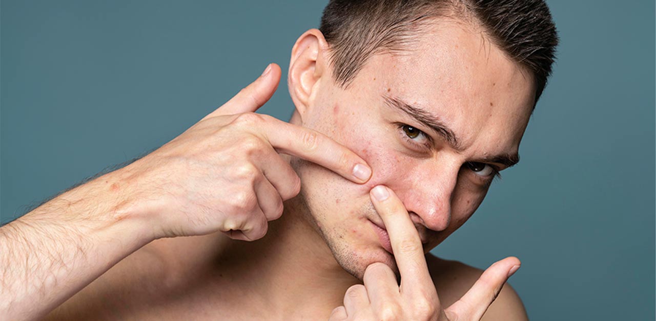 best face wash for pimples and dark spots